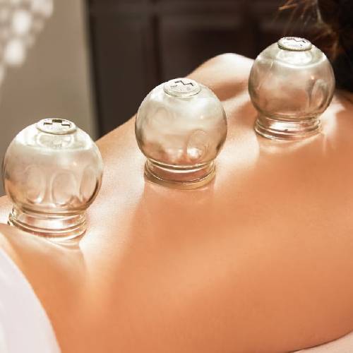 Cupping Therapy in Delhi