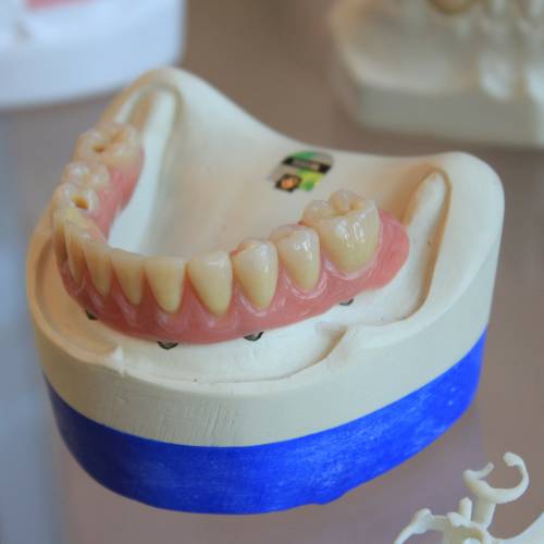 Dentures